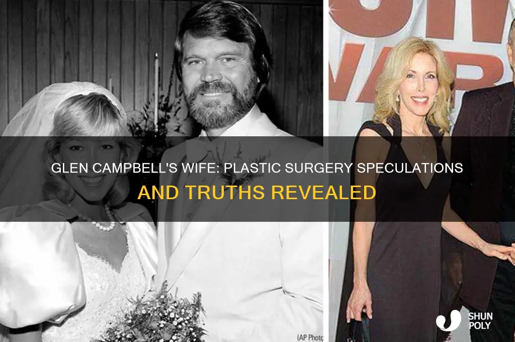 did glen cambells wife have plastic surgery