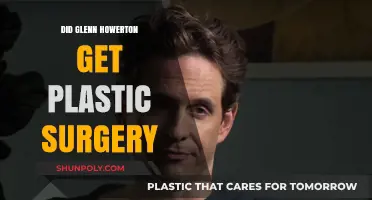 Glenn Howerton Plastic Surgery: Fact-Checking the Rumors and Speculation