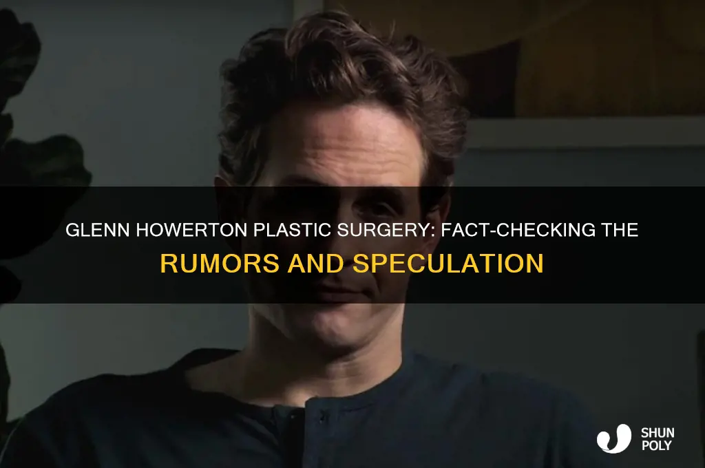 did glenn howerton get plastic surgery