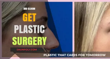 Did Gloom Undergo Plastic Surgery? Unveiling the Truth Behind Her Look