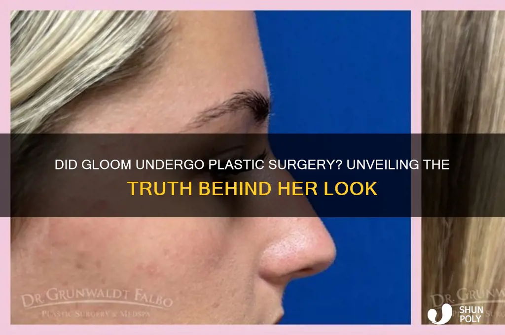 did gloom get plastic surgery