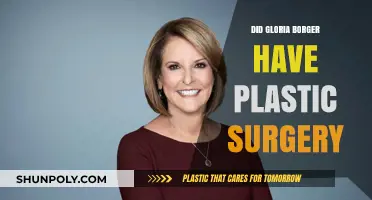 Gloria Borger Plastic Surgery: Fact-Checking the Rumors and Speculations