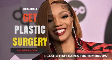Did Glorilla Undergo Plastic Surgery? Unveiling the Truth Behind the Rumors