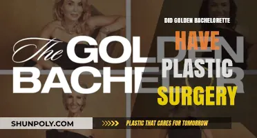 Golden Bachelorette's Transformation: Plastic Surgery Speculations and Truths