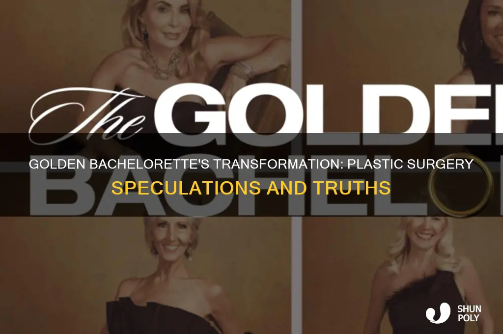 did golden bachelorette have plastic surgery