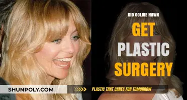 Goldie Hawn's Transformation: Plastic Surgery Rumors and Reality Revealed
