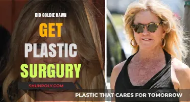 Goldie Hawn's Ageless Beauty: Plastic Surgery Speculations Explored