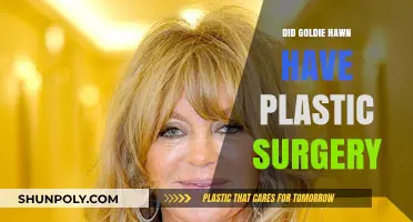 Goldie Hawn's Transformation: Plastic Surgery Speculations and Truths Revealed