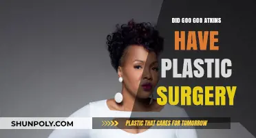 Goo Goo Atkins Plastic Surgery: Fact-Checking the Rumors and Speculations
