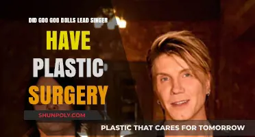Goo Goo Dolls' John Rzeznik: Plastic Surgery Rumors Explored