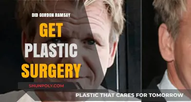 Did Gordon Ramsay Undergo Plastic Surgery? Unveiling the Truth