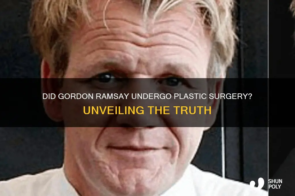 did gordon ramsay get plastic surgery