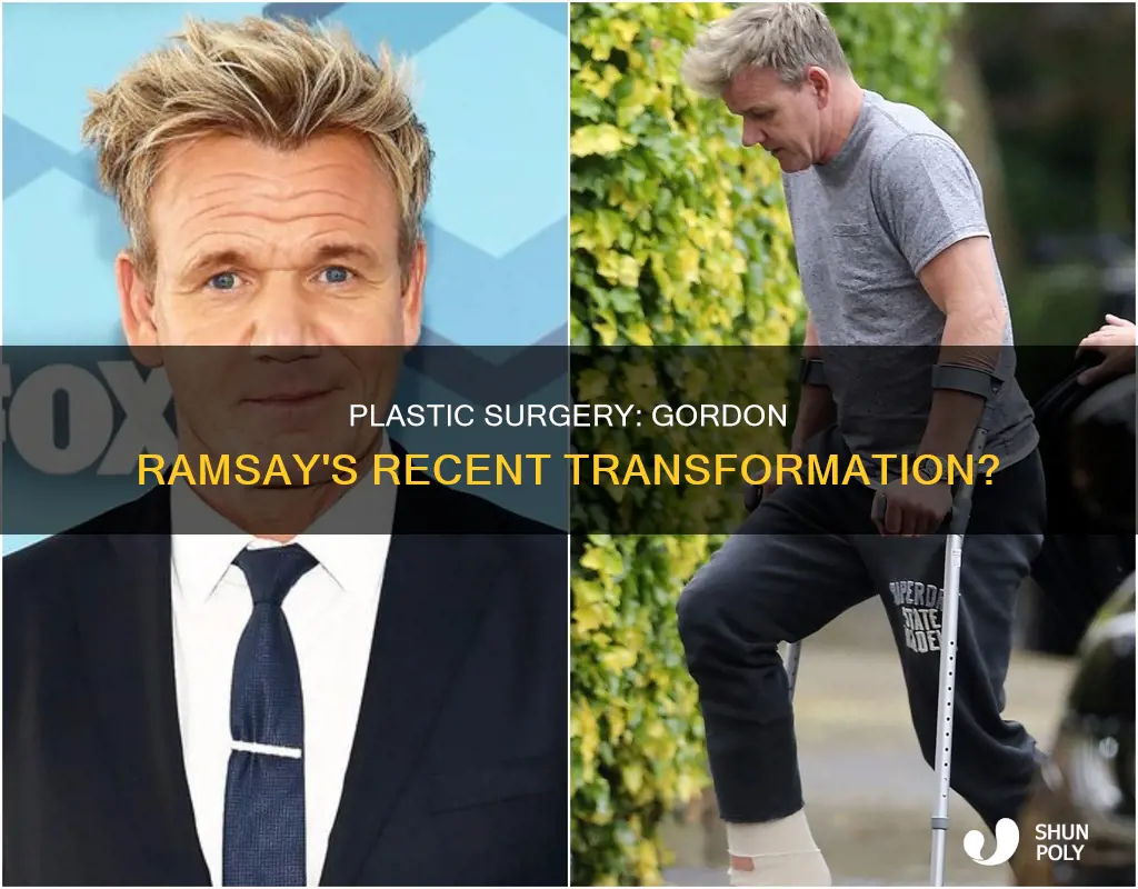 did gordon ramsay recently have plastic
