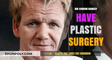 Gordon Ramsay's Transformation: Plastic Surgery Rumors Explored
