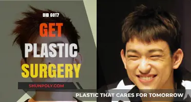 GOT7 Plastic Surgery: Unveiling the Truth Behind Their Transformations