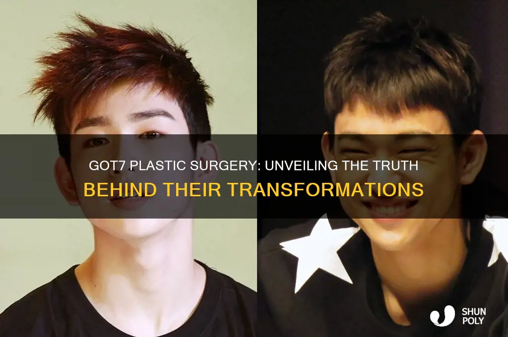 did got7 get plastic surgery