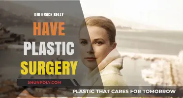 Grace Kelly's Beauty Secrets: Plastic Surgery Rumors Explored