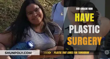 Gracie Bon Plastic Surgery: Fact-Checking the Rumors and Speculations