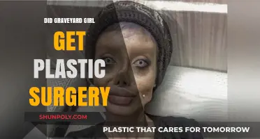 Graveyard Girl Plastic Surgery: Fact-Checking the Transformation Rumors
