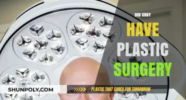 Did Gray Undergo Plastic Surgery? Uncovering the Truth Behind the Rumors