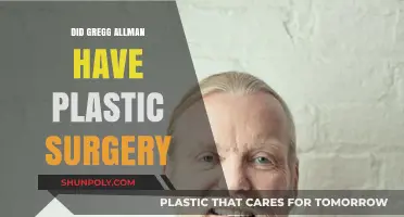 Gregg Allman's Transformation: Uncovering the Truth About Plastic Surgery