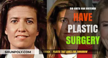 Greta Van Susteren's Transformation: Plastic Surgery Speculations Explored