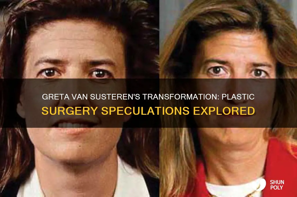 did greta van susteren have plastic surgery