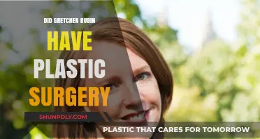 Gretchen Rubin Plastic Surgery: Fact-Checking the Rumors and Speculations