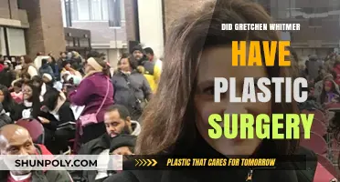 Gretchen Whitmer Plastic Surgery Speculations: Fact or Fiction?