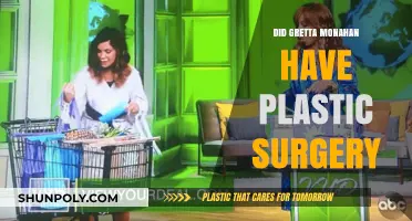 Gretta Monahan Plastic Surgery: Fact-Checking the Rumors and Speculations