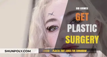 Grimes' Transformation: Unveiling the Truth About Plastic Surgery Rumors