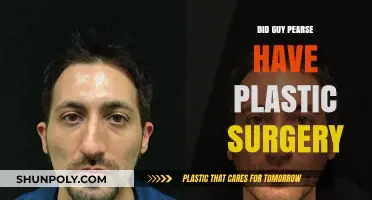 Guy Pearse Plastic Surgery: Uncovering the Truth Behind the Rumors