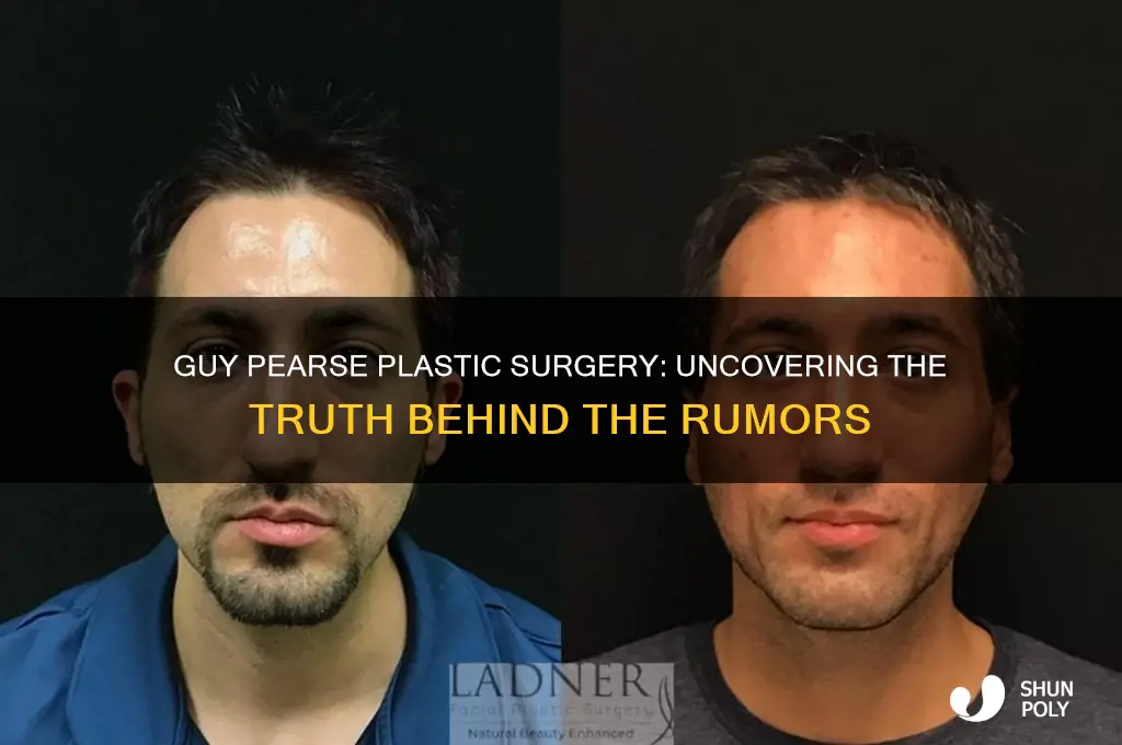 did guy pearse have plastic surgery
