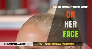 Gwen Stefani's Face: Natural Beauty or Plastic Surgery?