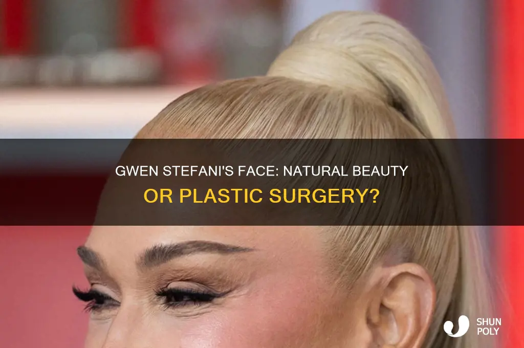 did gwen stefani get plastic surgery on her face