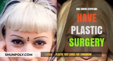 Gwen Stefani's Transformation: Plastic Surgery Rumors and Reality Revealed