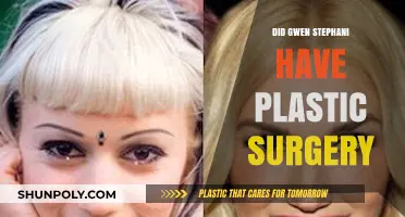 Gwen Stefani's Transformation: Plastic Surgery Speculations and Truths