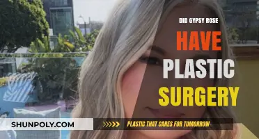 Gypsy Rose's Transformation: Plastic Surgery Speculations and Truths Revealed