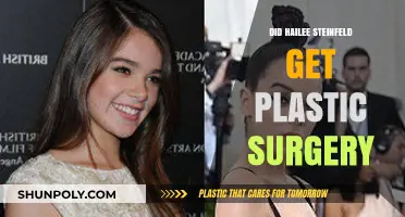 Hailee Steinfeld Plastic Surgery: Fact-Checking the Rumors and Speculations