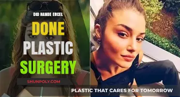 Hande Erçel Plastic Surgery: Fact-Checking the Rumors and Speculations