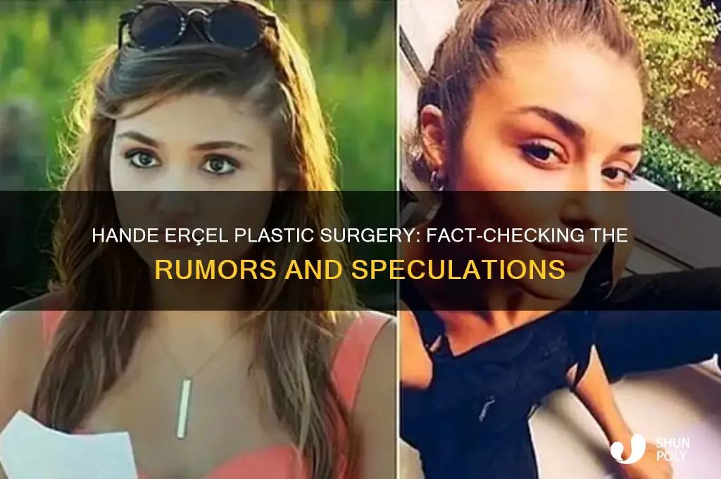 did hande ercel done plastic surgery