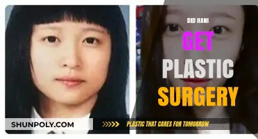 Did Hani Undergo Plastic Surgery? Unraveling the Truth Behind Her Transformation