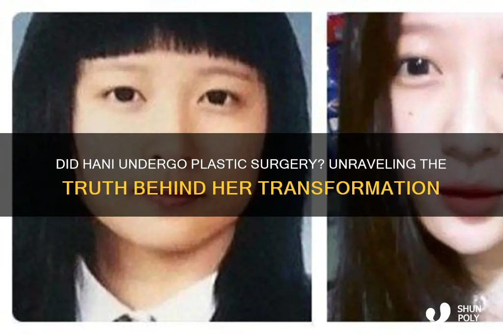 did hani get plastic surgery