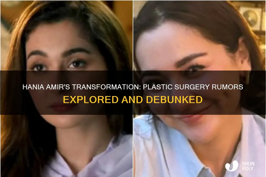 did hania amir do plastic surgery