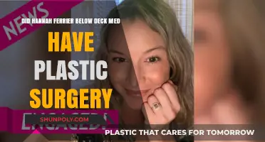 Hannah Ferrier's Transformation: Plastic Surgery Rumors on Below Deck Med
