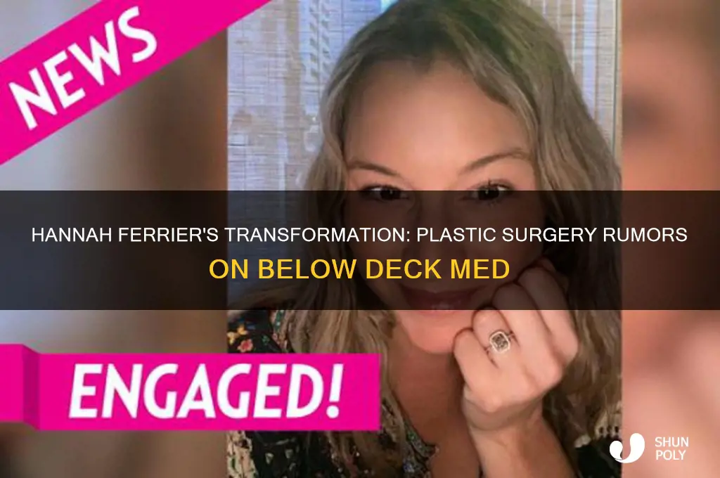 did hannah ferrier below deck med have plastic surgery