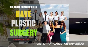 Hannah From Below Deck Plastic Surgery: Fact-Checking the Rumors