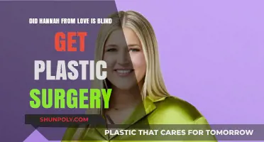 Hannah Love is Blind Plastic Surgery: Fact-Checking the Rumors