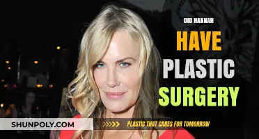 Did Hannah Undergo Plastic Surgery? Unveiling the Truth Behind Her Transformation