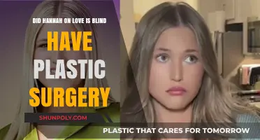 Did Hannah From Love is Blind Undergo Plastic Surgery?